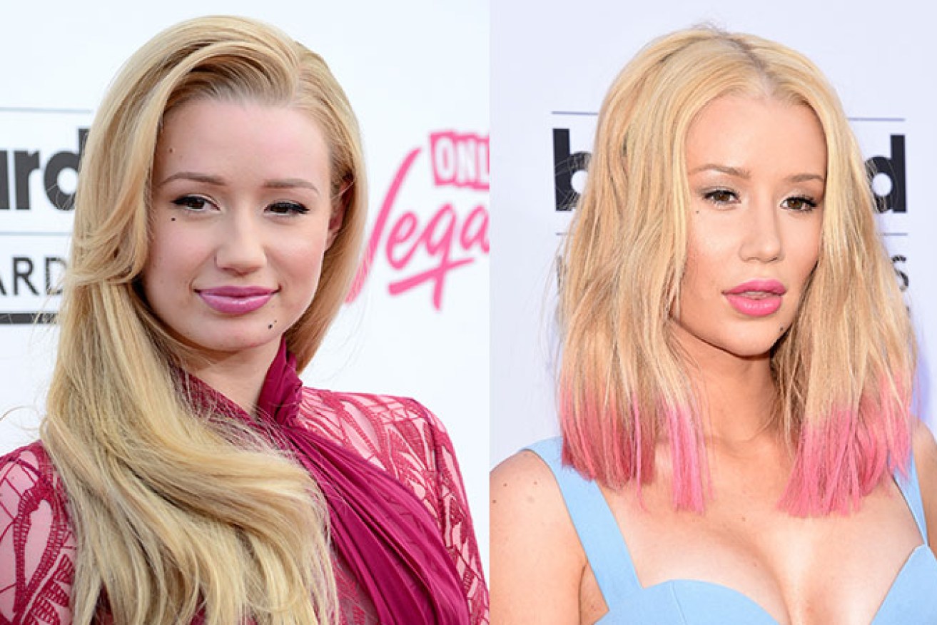 Iggy Azalea before (left) and after surgery.