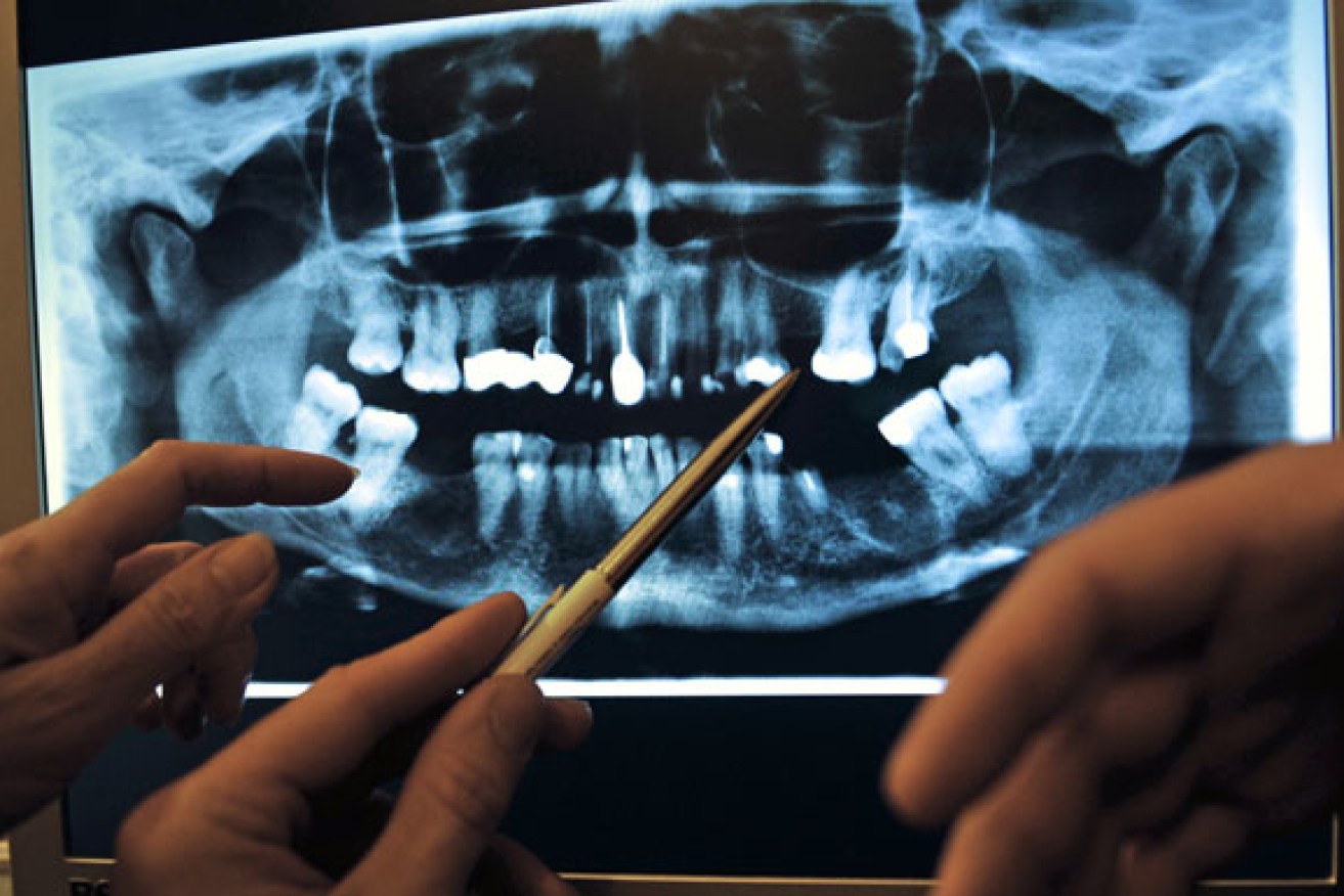 Poor dental health is dimming Australian smiles.<i>Photo: Getty</i>