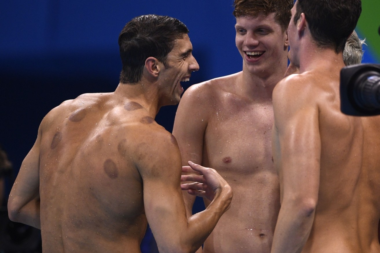 Michael Phelps' cupping marks had people questioning the practice during the Rio 2016 Olympics. 