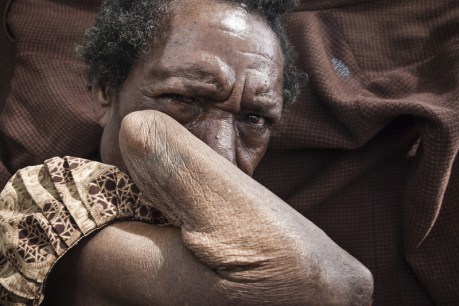 Ending sorcery attacks, violence against women in Papua New Guinea
