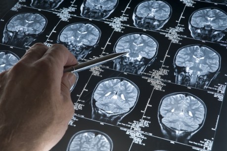 Alzheimer&#8217;s vaccine could soon be tested