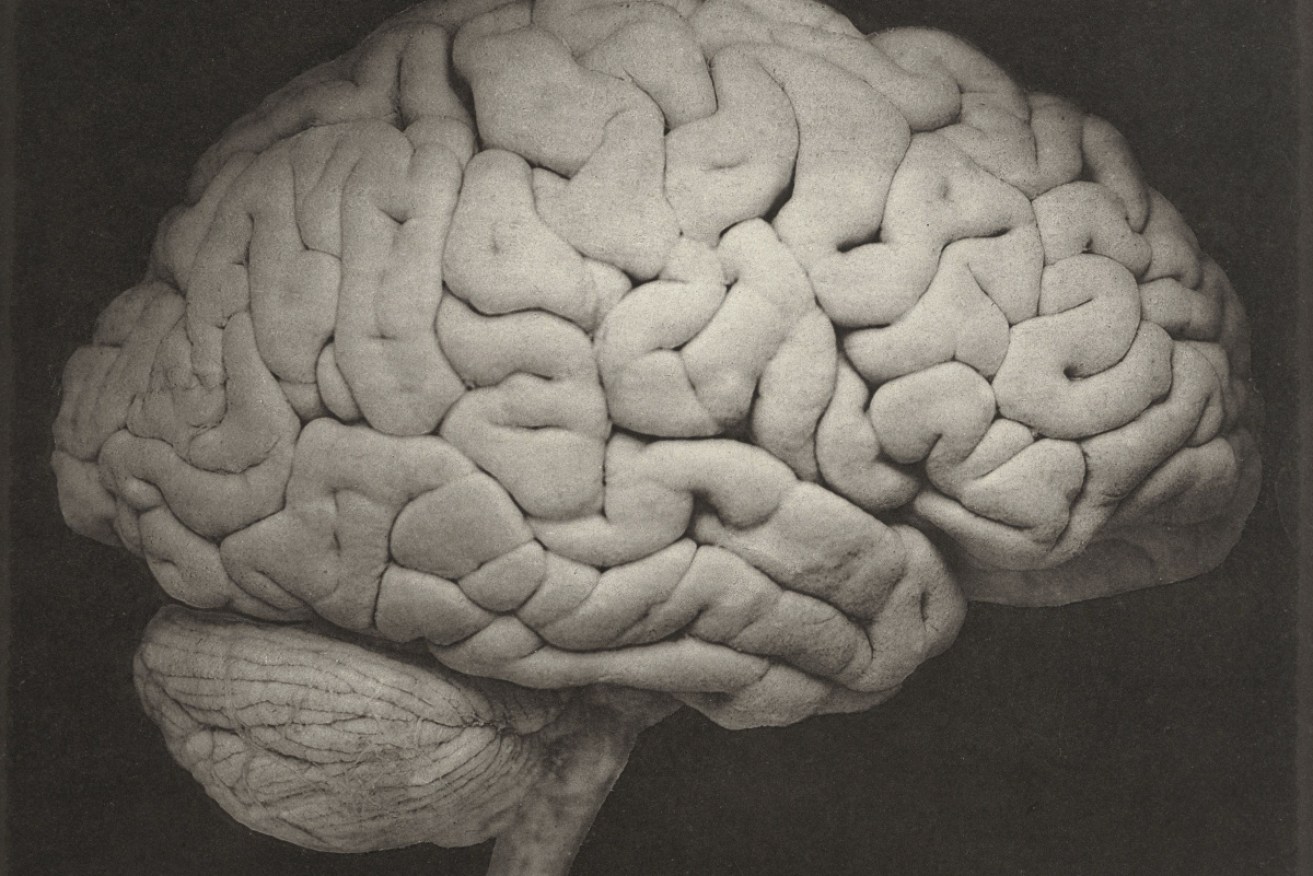 For the first time ever scientists have recorded the activity of a dying human brain. 