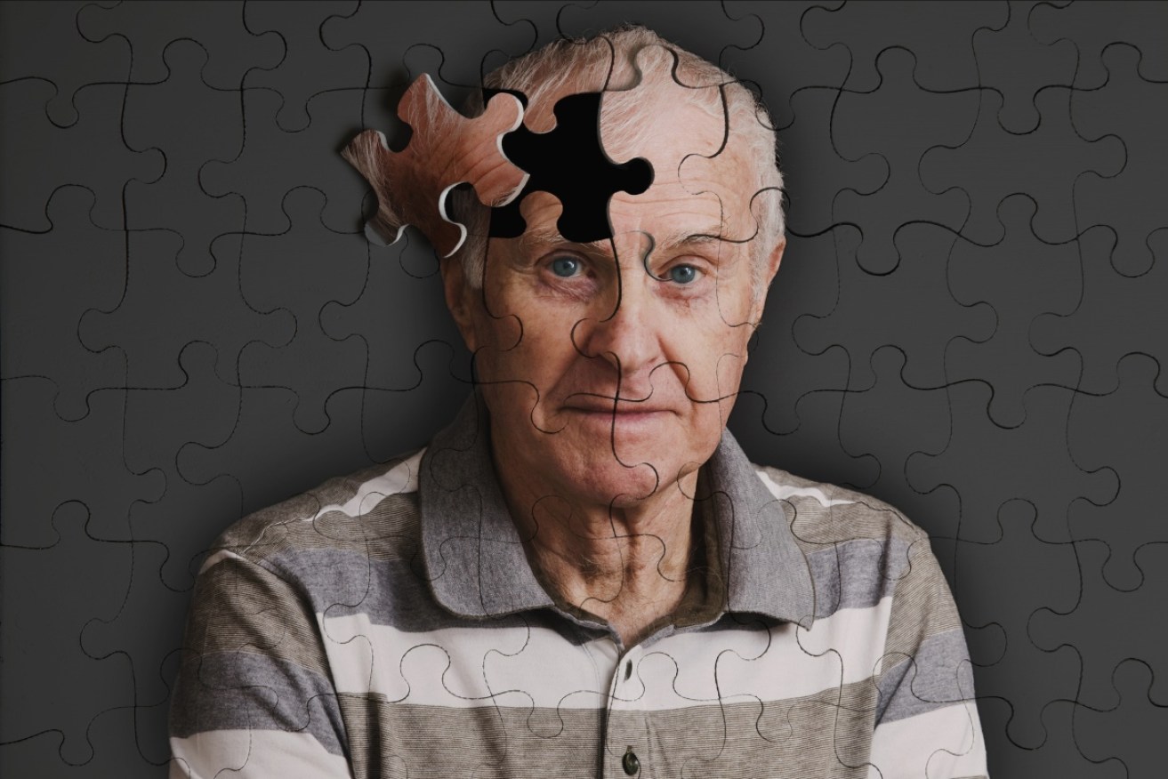 Researchers have described a biological mechanism for developing Alzheimer's disease. 