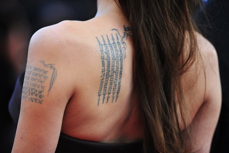 Rethink the ink: Tattoo removal is a growth industry