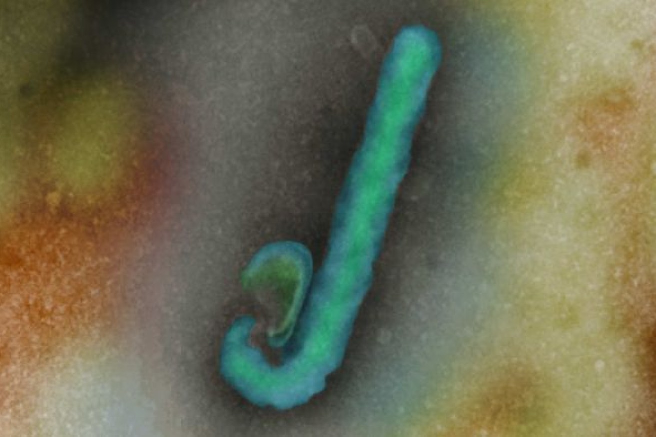The Ebola virus causes diarrhoea and internal and external bleeding.