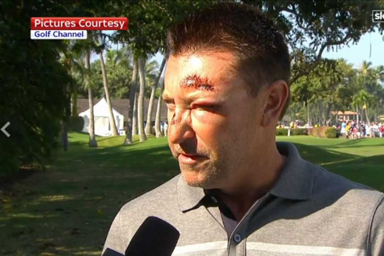 Robert Allenby after the attack in Hawaii. Photo: Channel Nine.