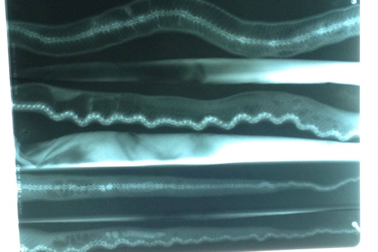Rocky's x-rays revealed the condition. Photo: Reptile Rescue Tasmania