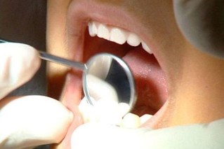 Thousands face tests over dentist disease risks