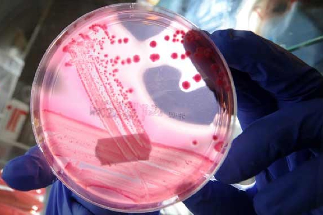 Anti-biotic resistant  superbugs are a big worry for medical researchers. 