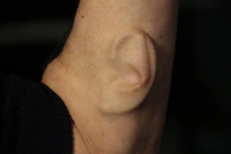 The Perth artist growing a human ear on his arm