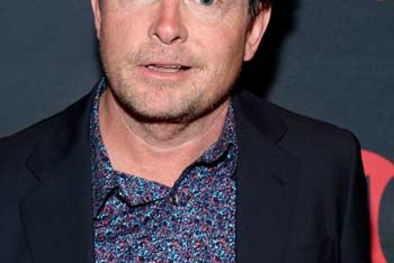Actor Michael J. Fox was diagnosed with Parkinson's disease in 1991 after noticing a twitch in his little finger. Photo: Getty