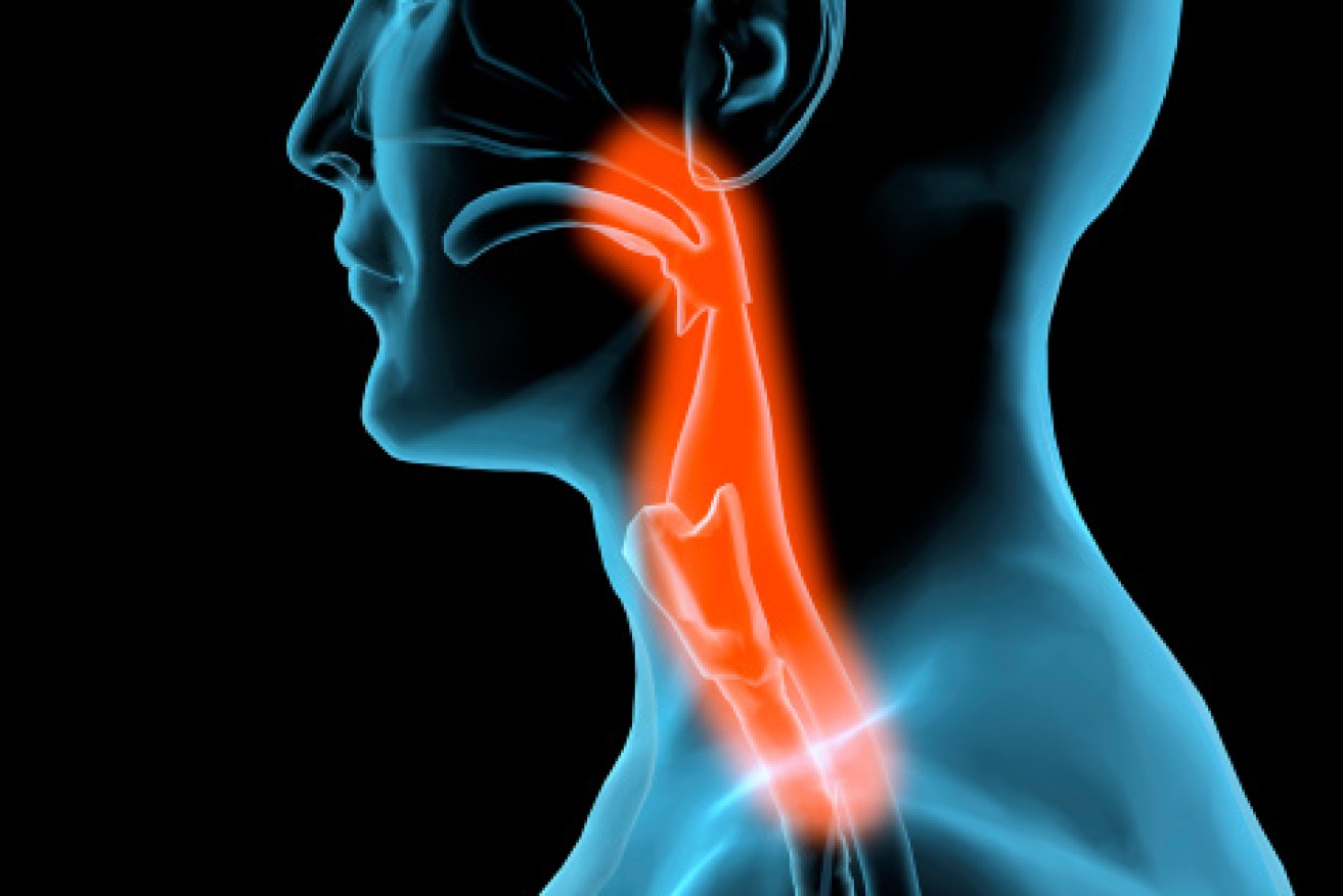 Cancer can damage the larynx (voice box). Photo: Getty 