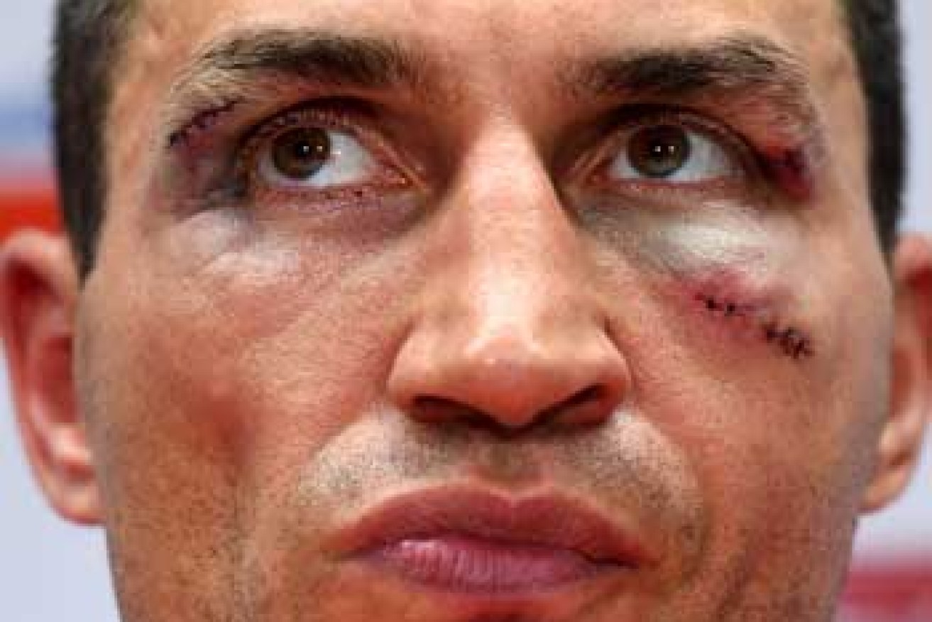Wladimir Klitschko's face told the story of the bout. Photo: Getty