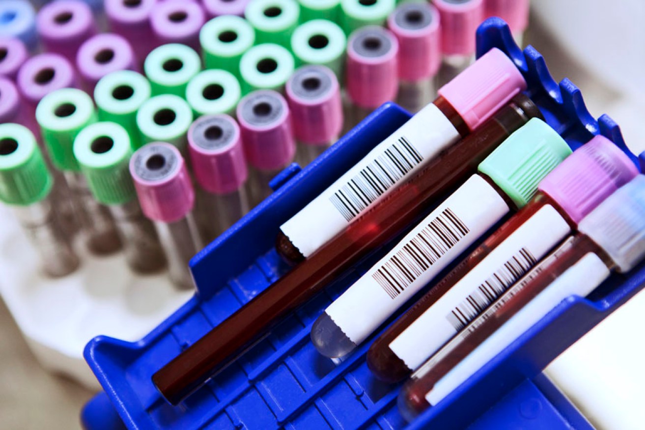 Researchers hope to develop a blood test to identify genes linked to breast cancer.