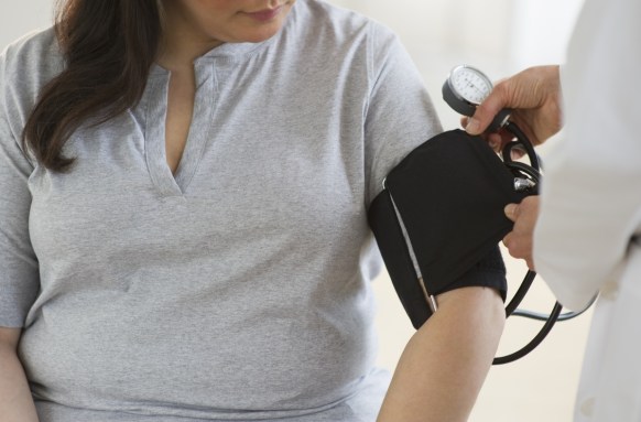 obesity and pregnancy