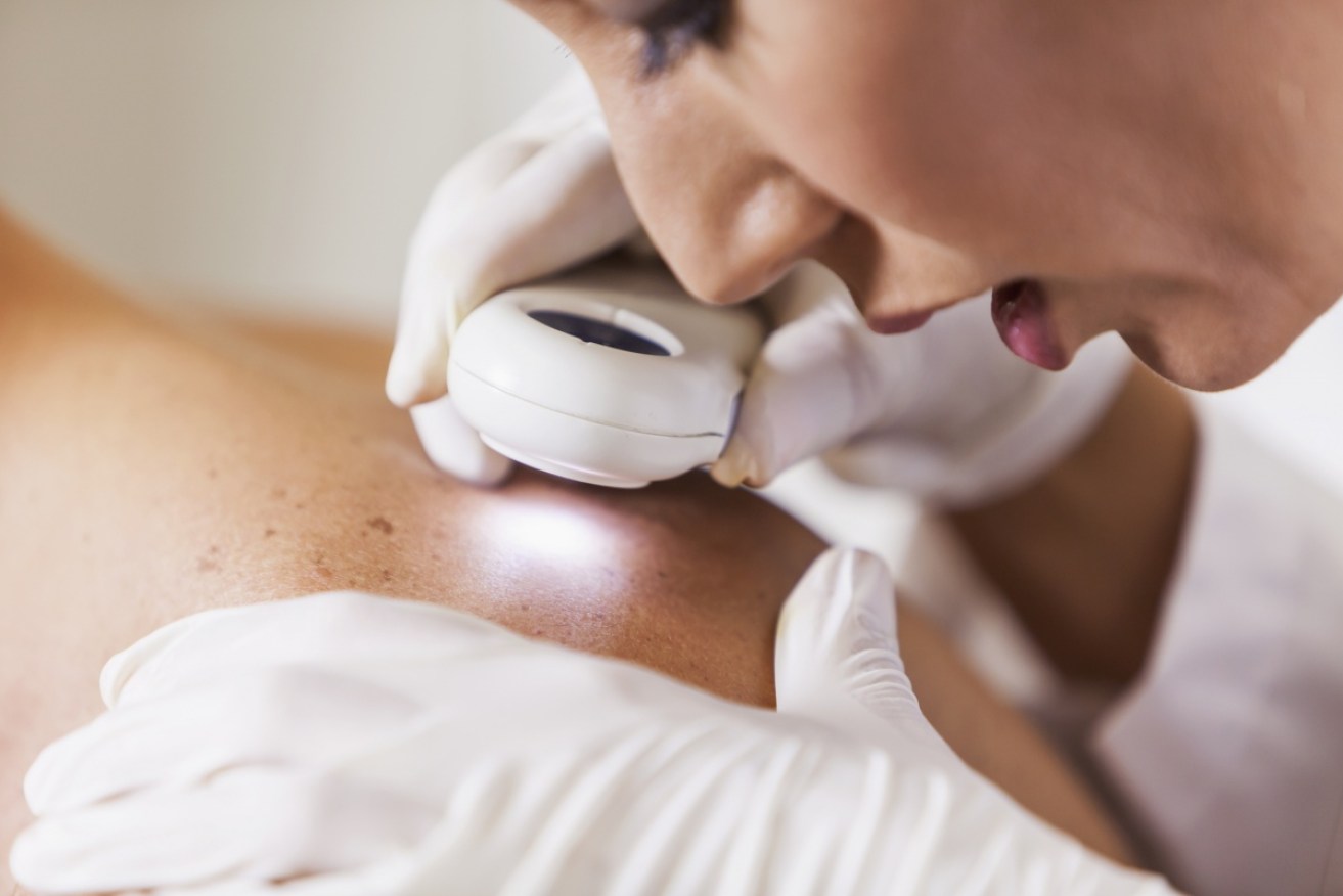 Around 13,000 people are diagnosed with skin cancer in Australia each year.