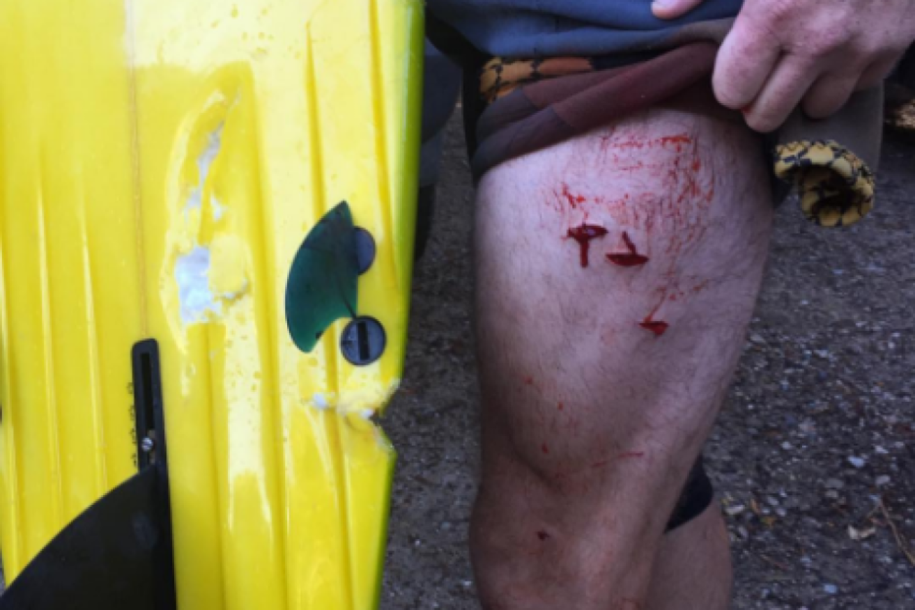 The man was bitten on the leg while surfing south of Cape Byron.
