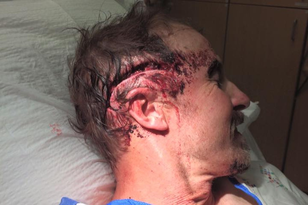 Todd Orr was attacked by a bear – twice – and lived to post the tale on social media.