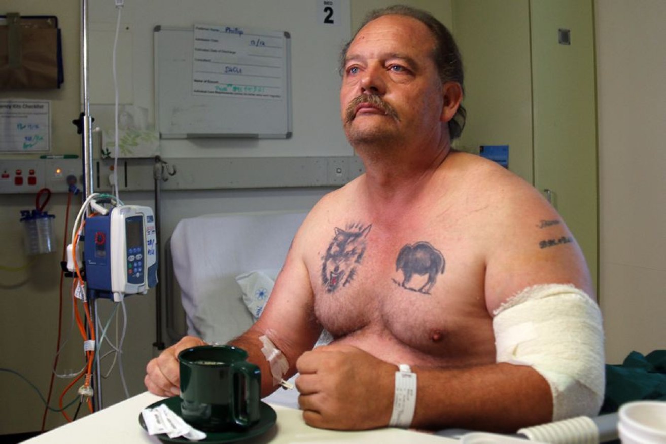 Phillip Boyd says he is lucky to be alive after being attacked by an injured water buffalo.