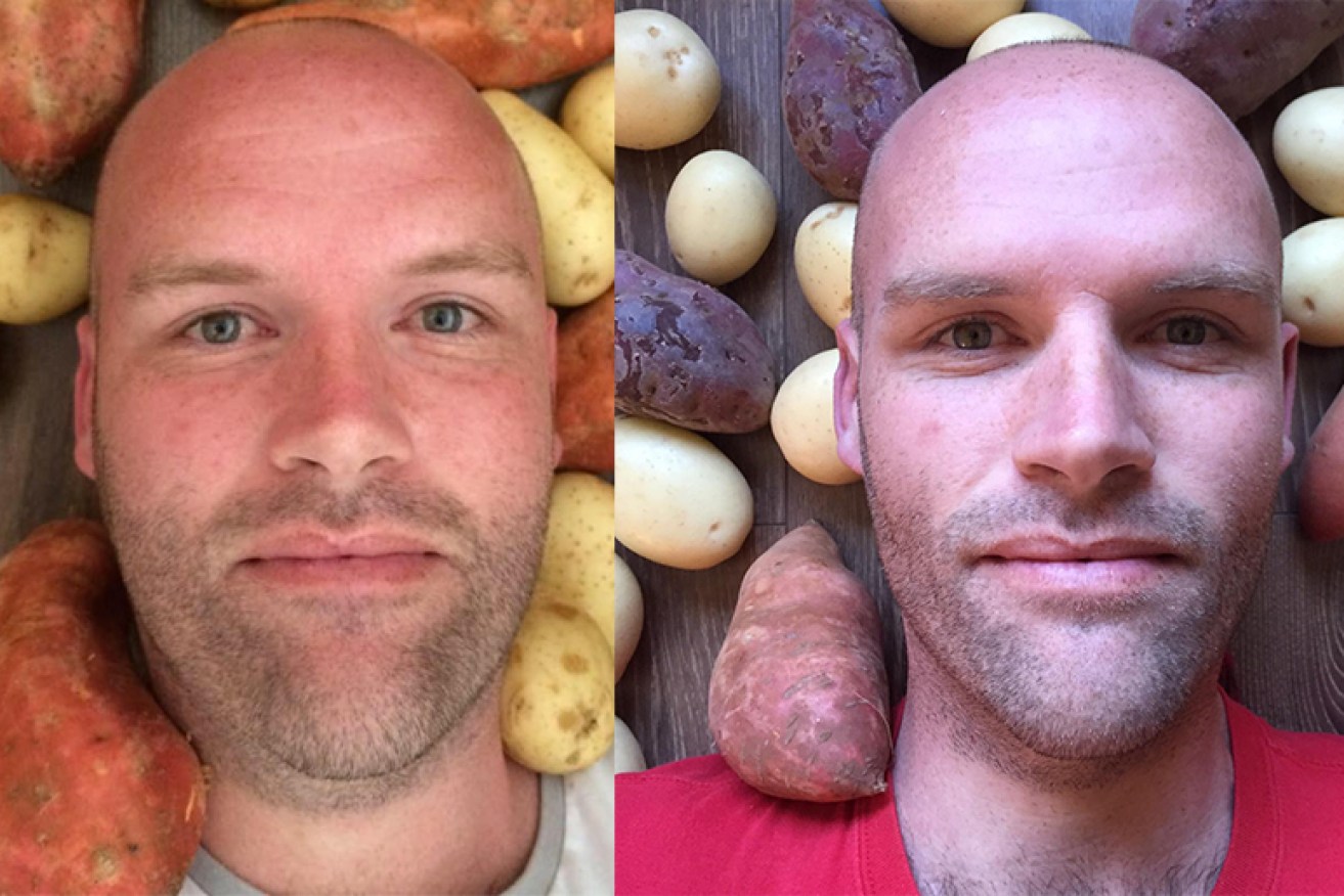 Andrew Taylor lost 50kg eating nothing but potatoes. 