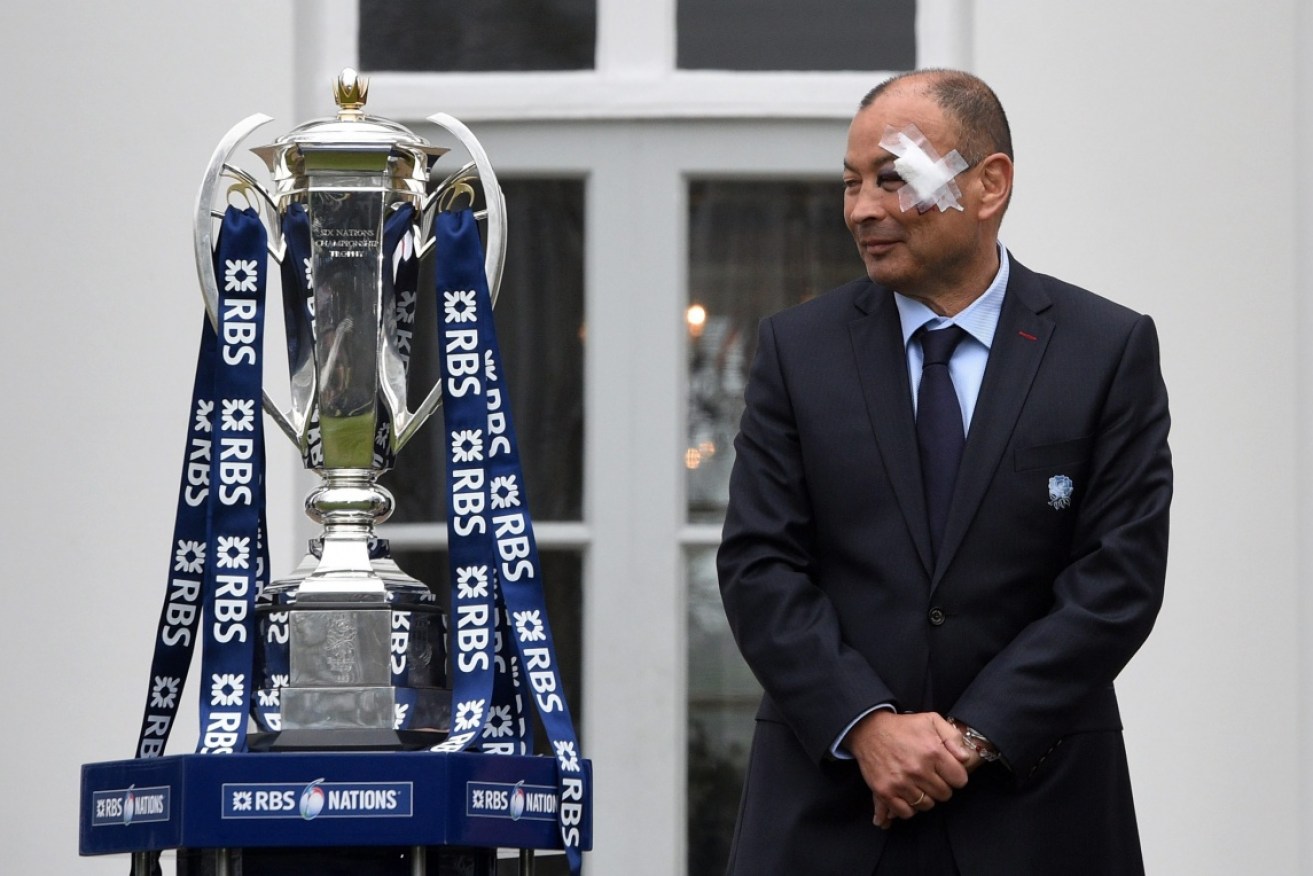 Eddie Jones shows off his injuries while posing with the Six Nations trophy. 