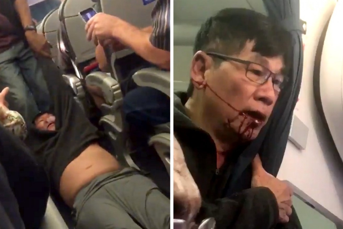Dr Dao was forcibly removed from the United Airlines flight.