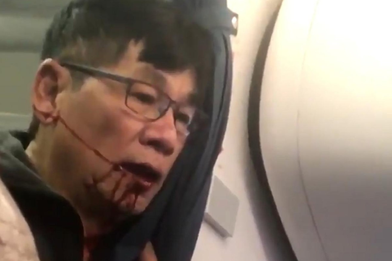 United Airlines has reached an undisclosed settlement with the man dragged from its flight.