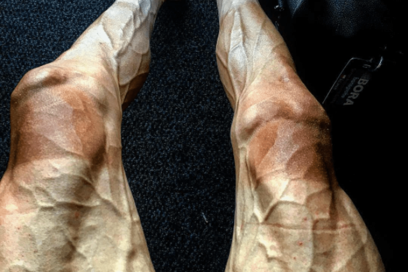 Polish cyclist Pawel Poljanski has shared a photo of his veiny legs after a gruelling 16 stages of Tour de France.