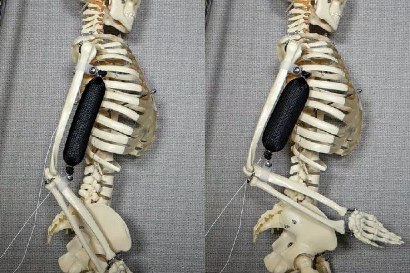 The artificial muscle in use as a bicep lifts a skeleton's arm to a 90 degree position.