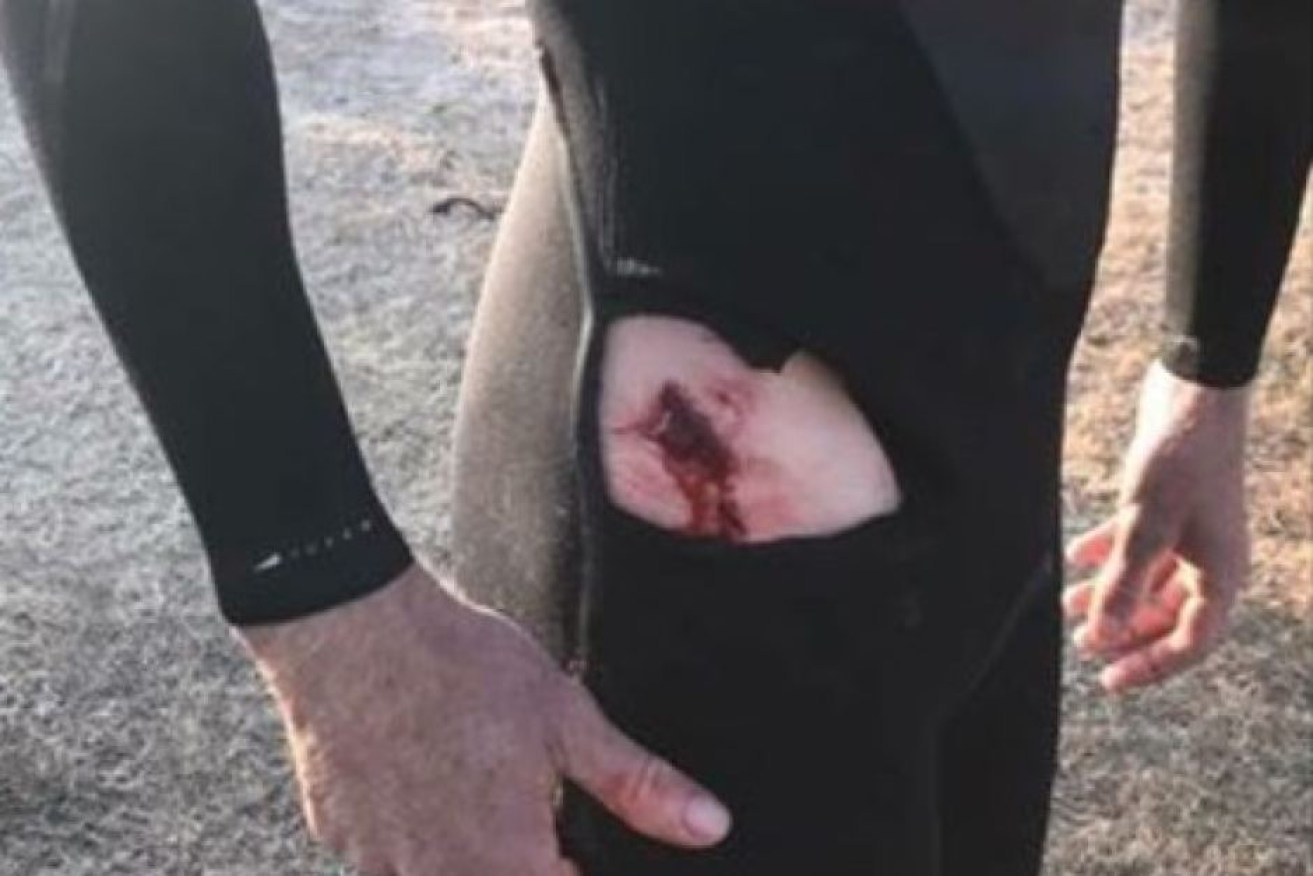 The surfer drove himself to hospital after suffering a gash on his leg.