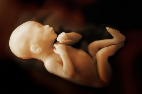 Stillbirth breakthrough: Australian researcher discovers why some babies don&#8217;t make it