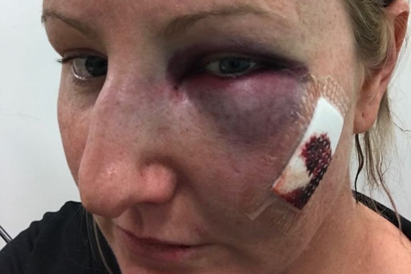 Samantha Mitchell says she was punched by an off-duty police officer when she was trying to get help.