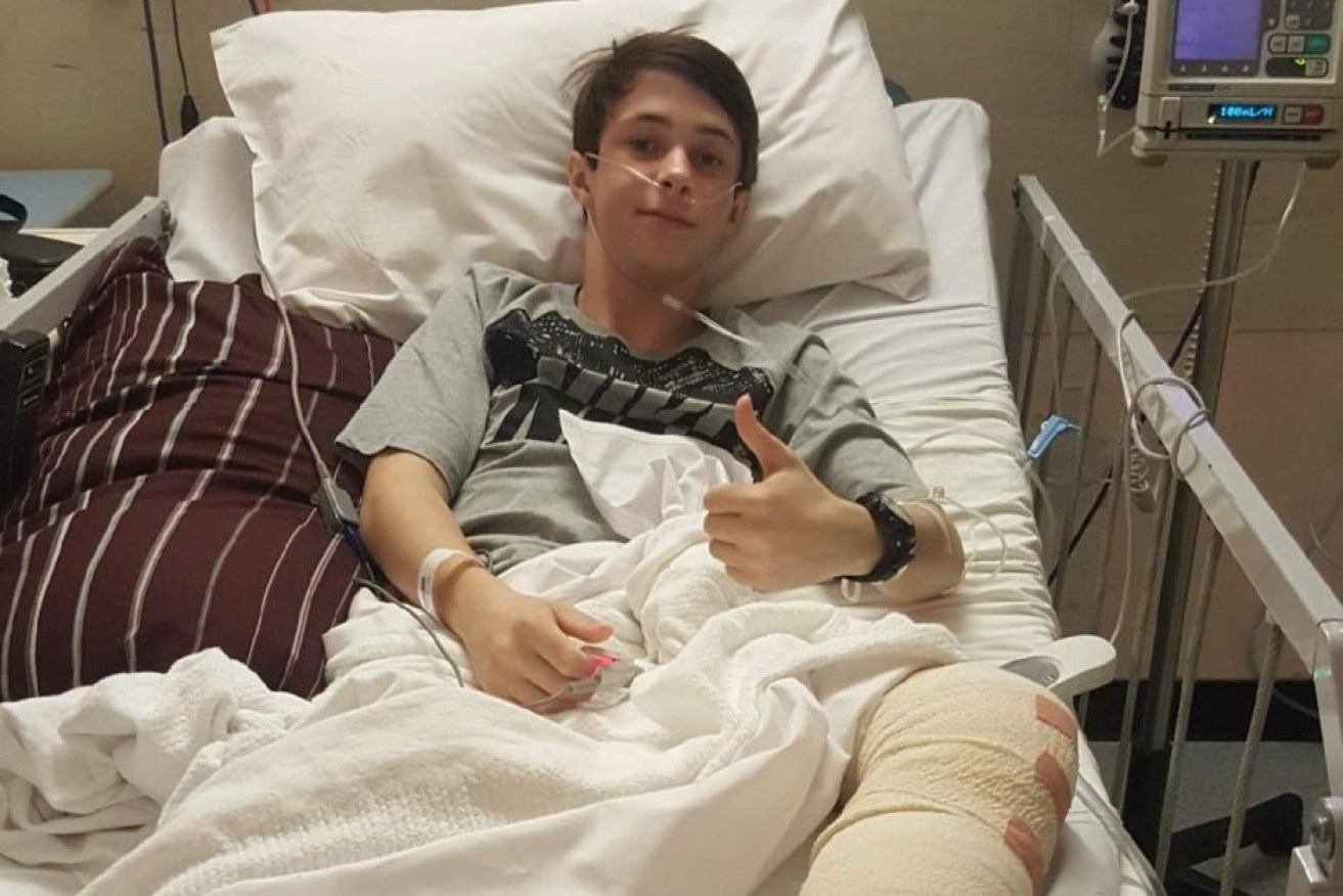 Teenager Adam Bart spent four months recovering after breaking his leg at a trampoline centre.