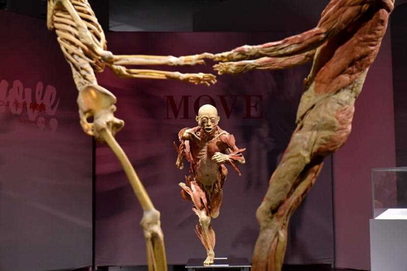The Real Bodies exhibition will open in Sydney on Saturday.