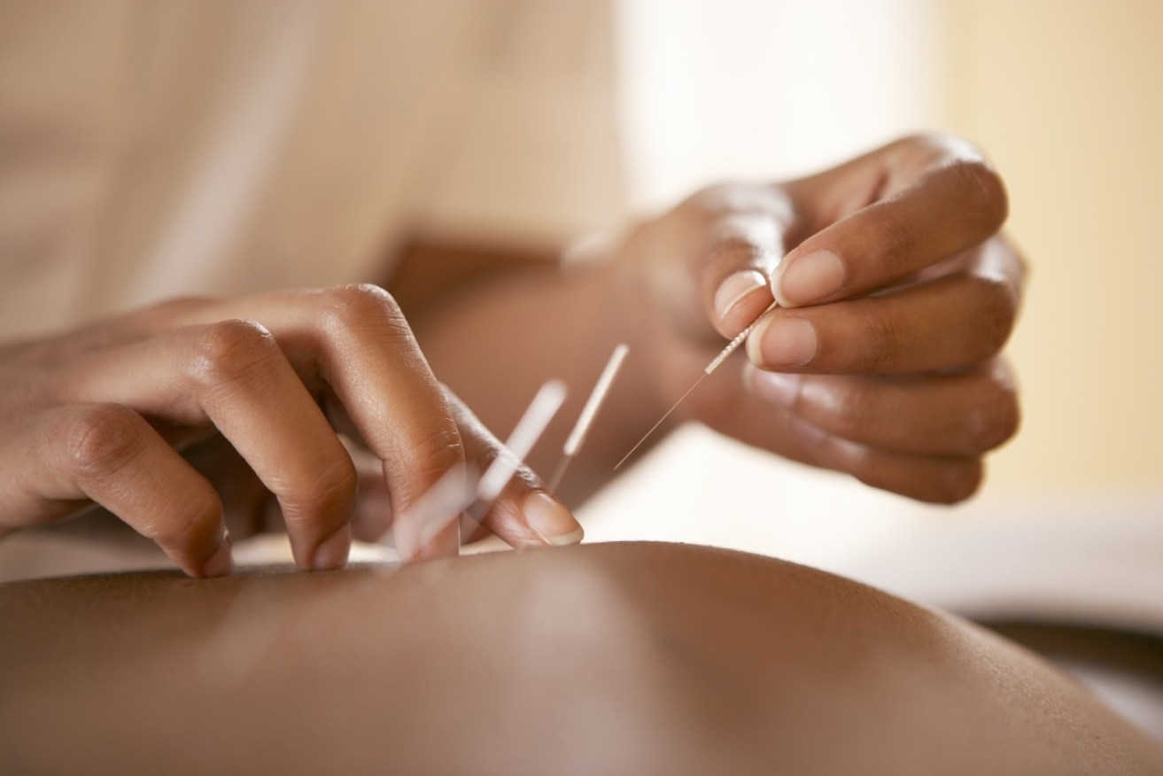 One of the most expensive forms of acupuncture might not even work.