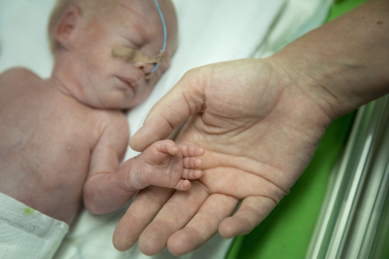 The study's findings about oxygen levels will give pre-term babies a greater chance of survival. 