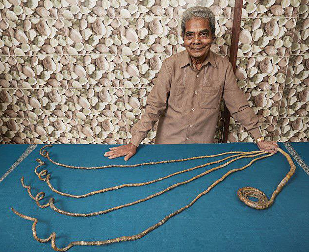 Man with world's longest fingernails grabs the clippers after 66 years -  ABC News