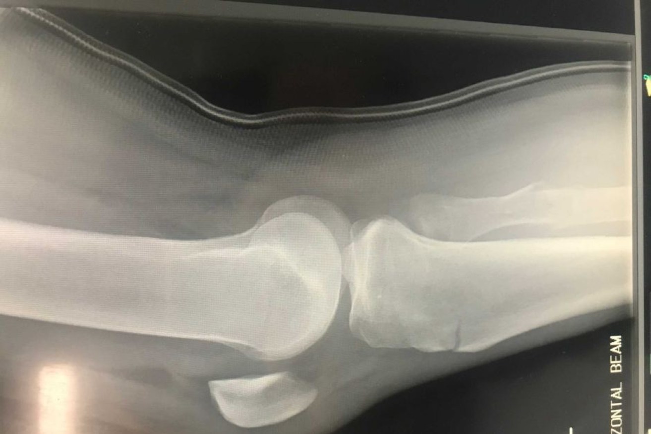 The 25-year-old man broke his left leg in two places and sustained a dislocated knee after hitting the water.

