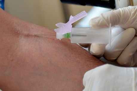 Melanoma blood test could detect skin cancer early