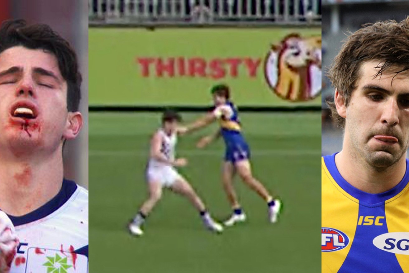 A punch given way too much attention? Andrew Gaff badly injures Andrew Brayshaw on August 5.