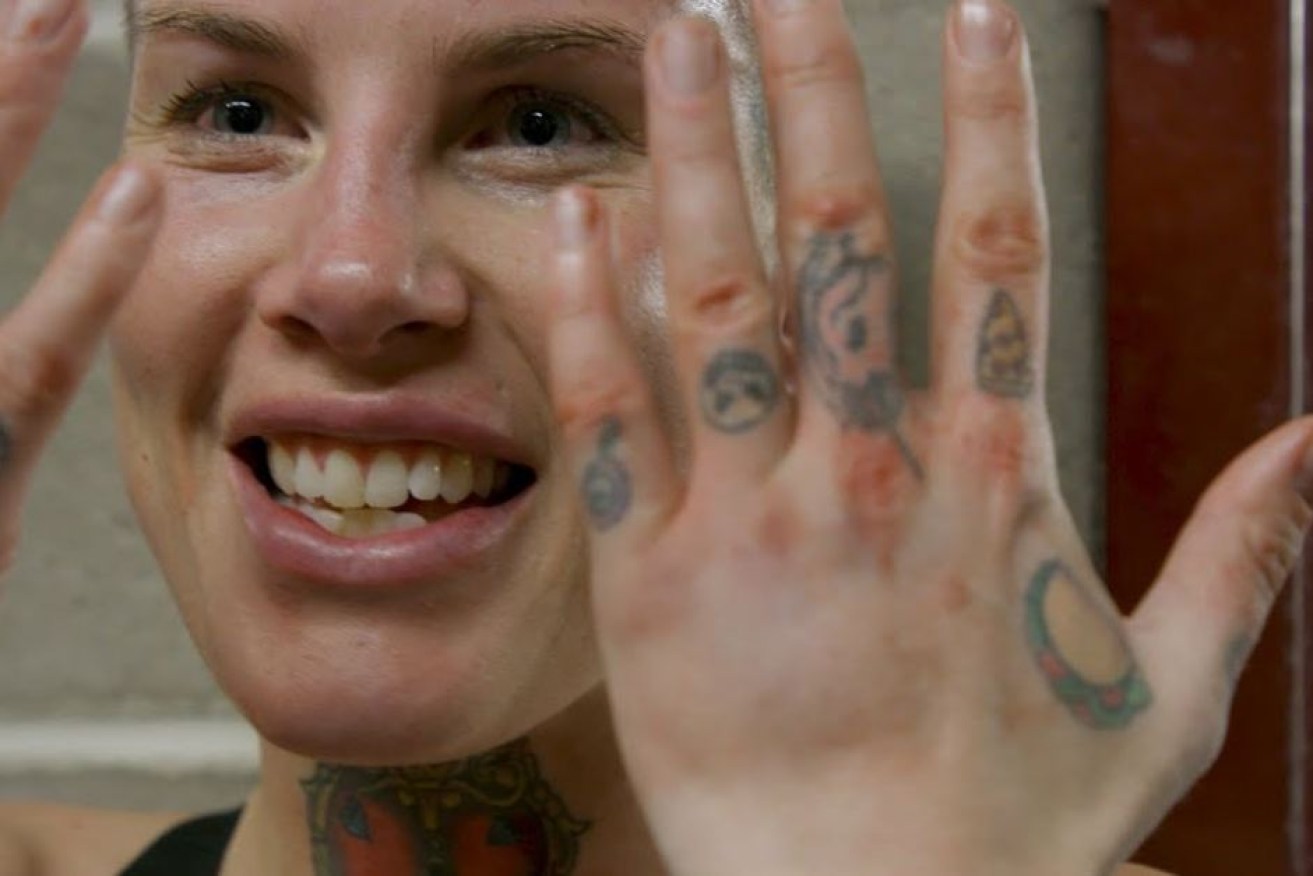 Bec Rawlings and her fight-ravaged hands. 