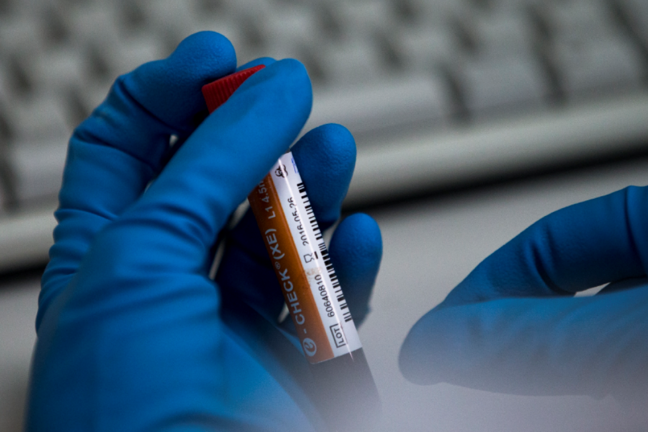 Russia has told WADA it will surrender dope-test samples, but only when it is good and ready.