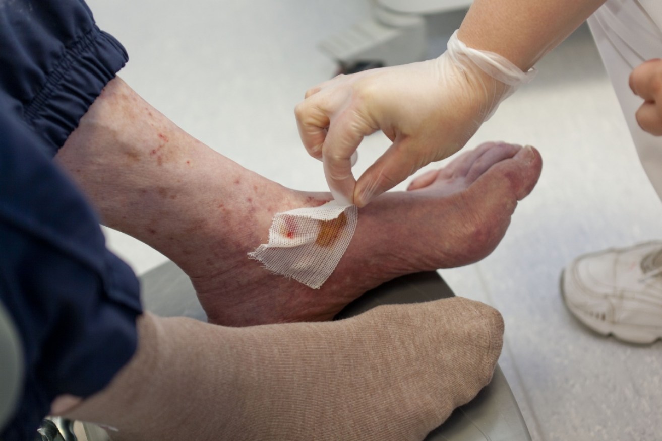 Regular foot care is essential for those with diabetes. 