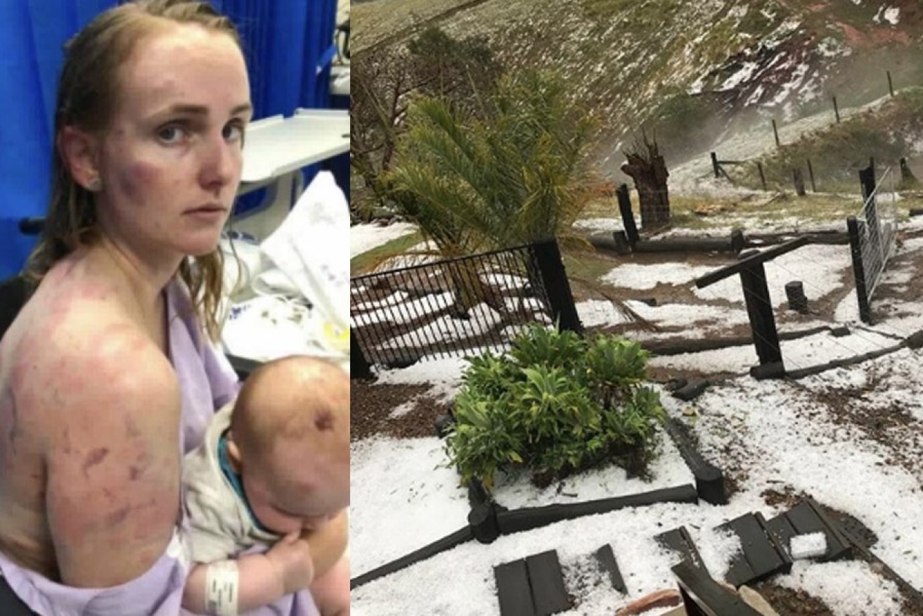 Hail broke the back window of Fiona Simpson's car in Queensland. Her skin formed welts while protecting her newborn daughter.
