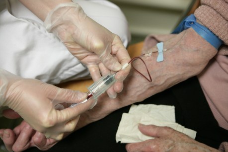 Blood test could detect early Alzheimer&#8217;s