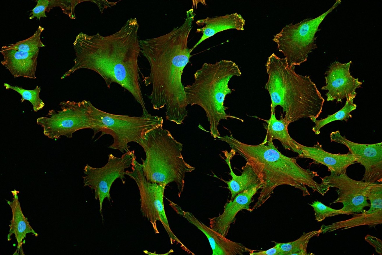 Fluorescently labelled stem cells growing on the tropoelastin protein.