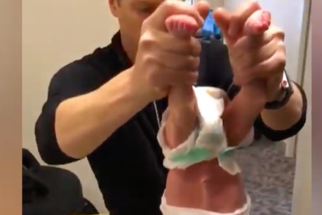 ‘Horrifying&#8217; chiropractor footage stresses need for parents to think long and hard about infant therapies