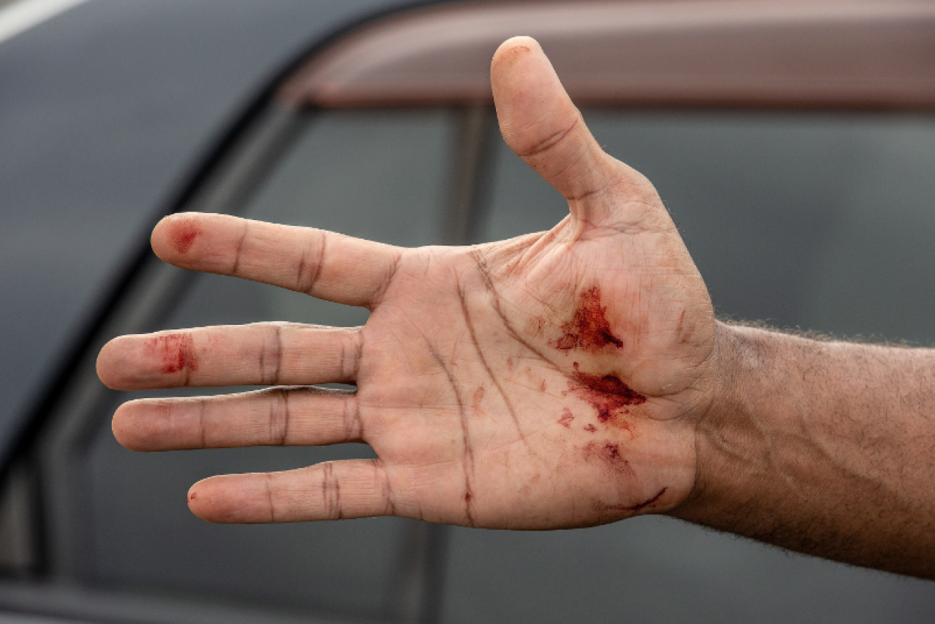 A survivor's hand, red with the blood of an innocent he tried to help in Wellington. 