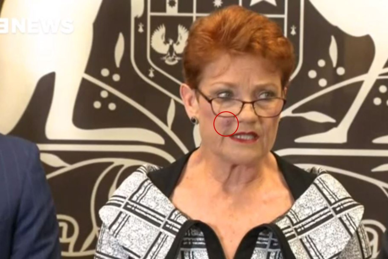 One Nation Senator Pauline Hanson's delayed appearance was supposedly due to a tick bite she suffered recently. 