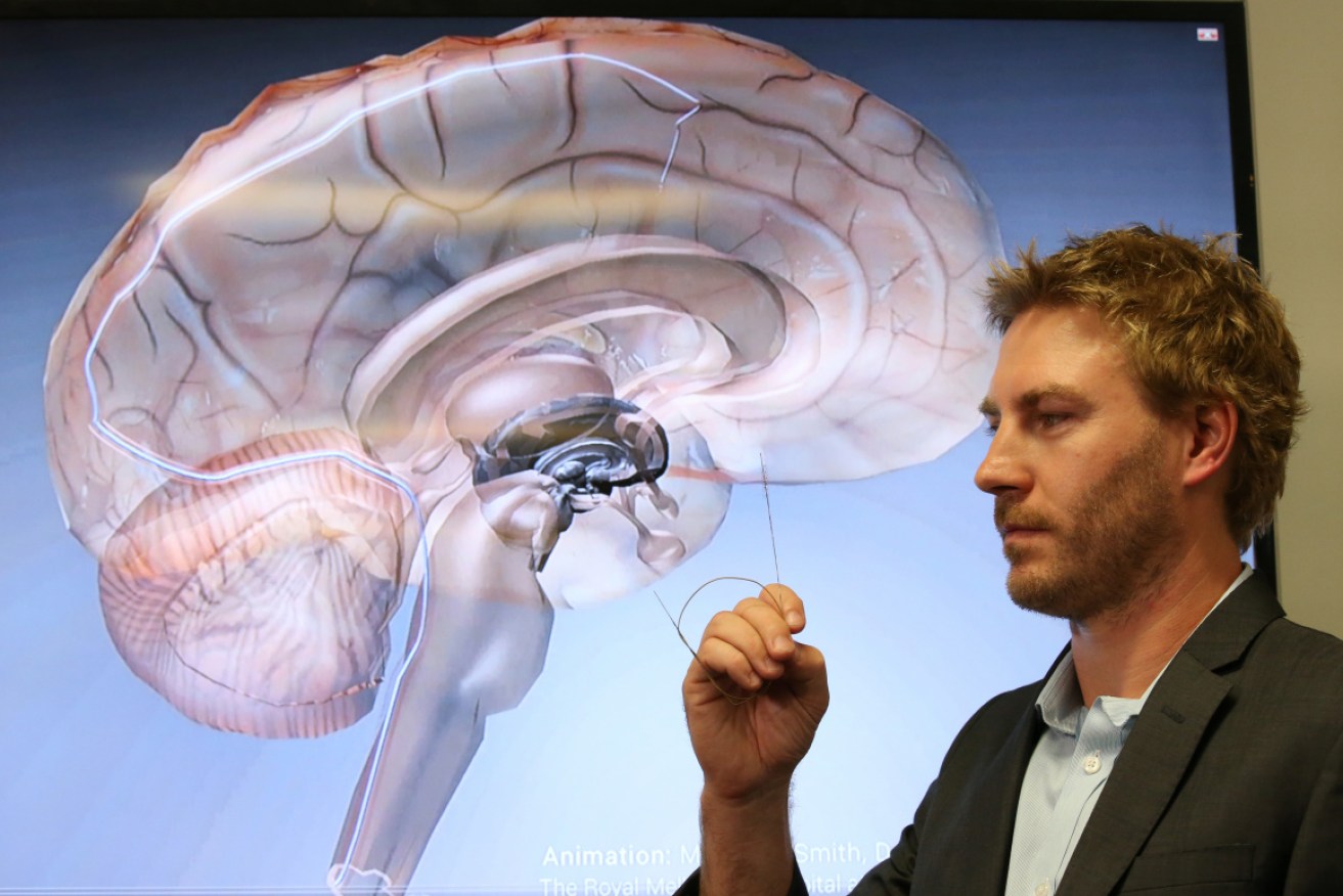 Dr Nicholas Opie with a "revolutionary" brain implant that may one day enable people with spinal cord injuries to walk again. 